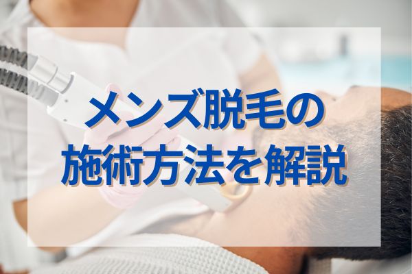 メンズ脱毛の施術方法を解説